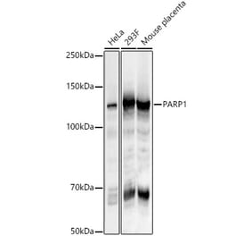 Western Blot - Anti-PARP1 Antibody (A87972) - Antibodies.com
