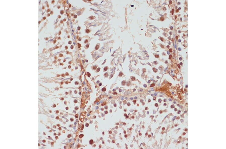 Immunohistochemistry - Anti-PARP1 Antibody (A87972) - Antibodies.com