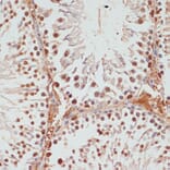 Immunohistochemistry - Anti-PARP1 Antibody (A87972) - Antibodies.com