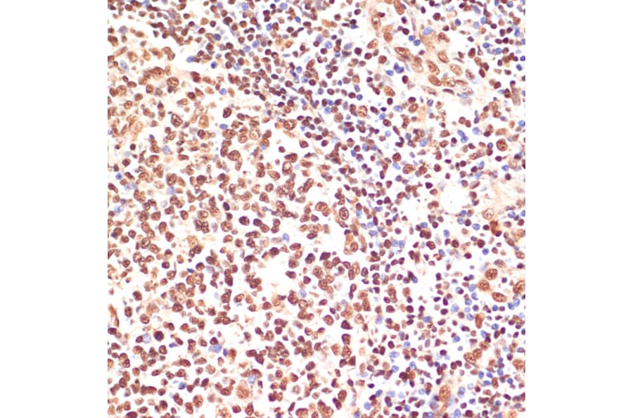 Immunohistochemistry - Anti-PARP1 Antibody (A87972) - Antibodies.com