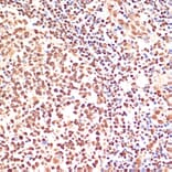 Immunohistochemistry - Anti-PARP1 Antibody (A87972) - Antibodies.com