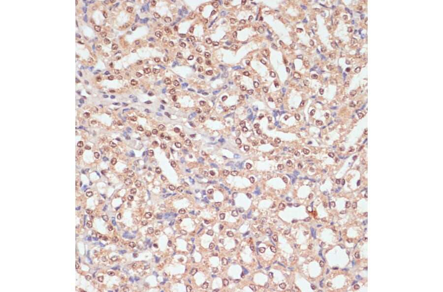 Immunohistochemistry - Anti-PARP1 Antibody (A87972) - Antibodies.com