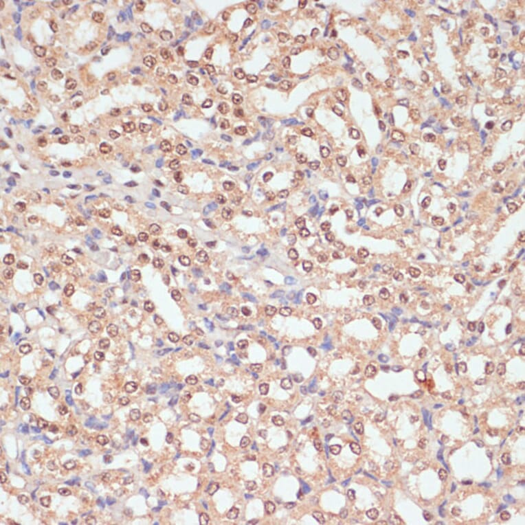 Immunohistochemistry - Anti-PARP1 Antibody (A87972) - Antibodies.com