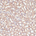 Immunohistochemistry - Anti-PARP1 Antibody (A87972) - Antibodies.com
