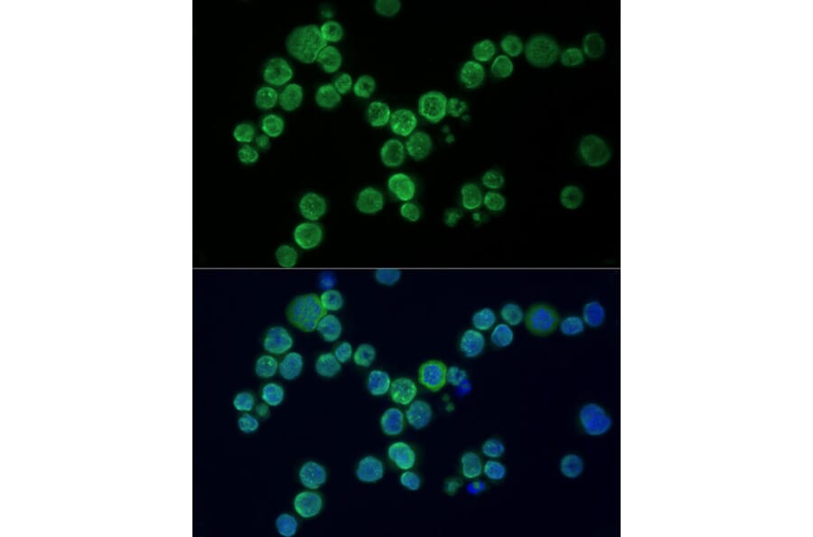 Immunofluorescence - Anti-PARP1 Antibody (A87972) - Antibodies.com