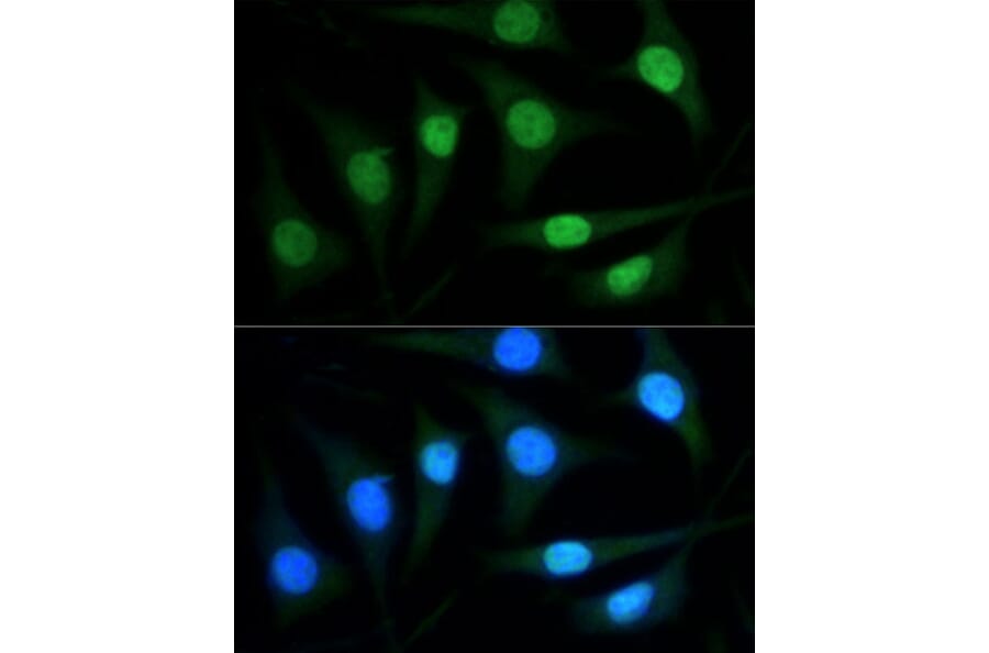 Immunofluorescence - Anti-PARP1 Antibody (A87972) - Antibodies.com