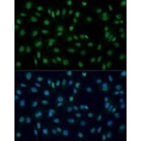 Immunofluorescence - Anti-PARP1 Antibody (A87972) - Antibodies.com