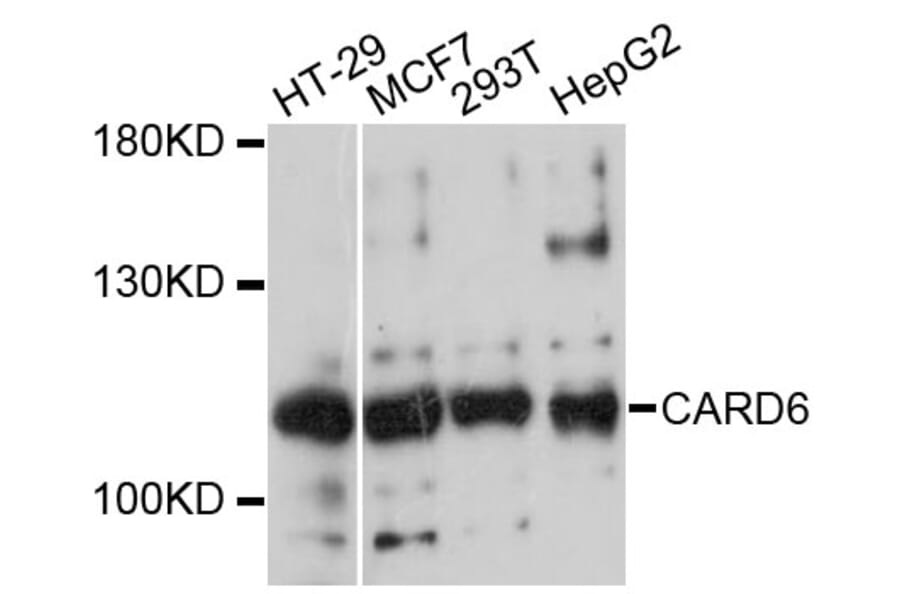 Western Blot - Anti-CARD6 Antibody (A13806) - Antibodies.com