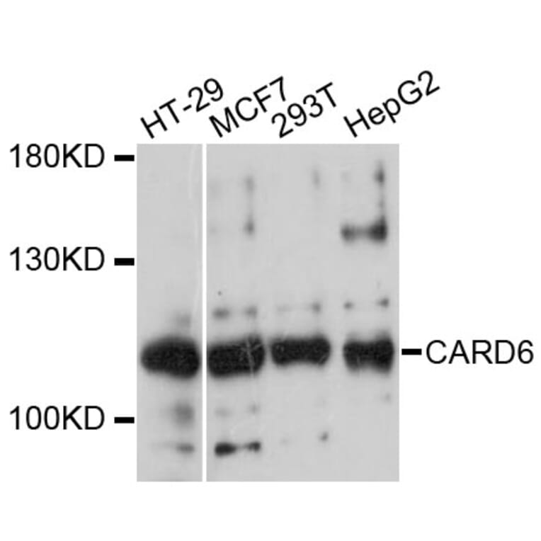 Western Blot - Anti-CARD6 Antibody (A13806) - Antibodies.com