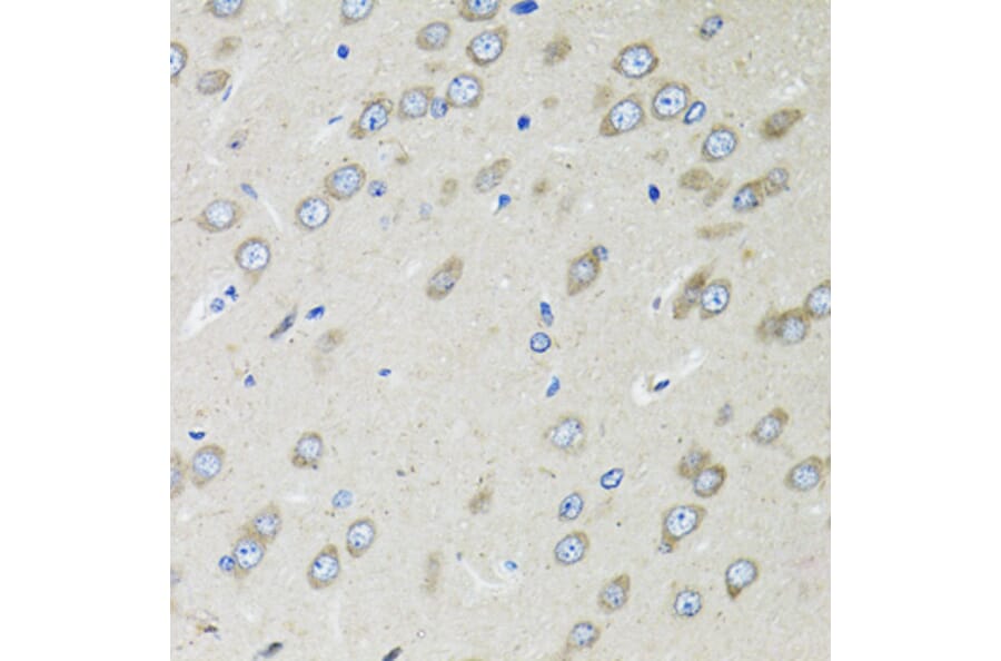 Immunohistochemistry - Anti-OGDH Antibody (A87976) - Antibodies.com