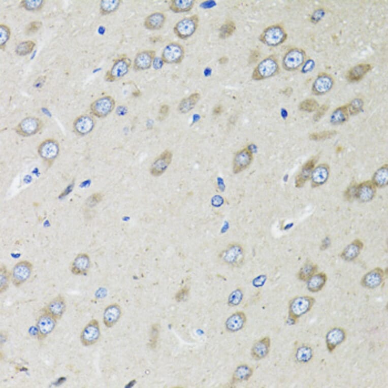 Immunohistochemistry - Anti-OGDH Antibody (A87976) - Antibodies.com