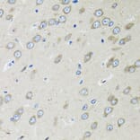 Immunohistochemistry - Anti-OGDH Antibody (A87976) - Antibodies.com
