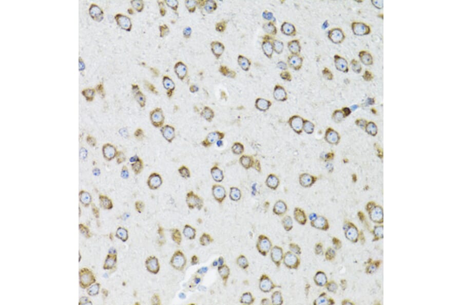Immunohistochemistry - Anti-OGDH Antibody (A87976) - Antibodies.com