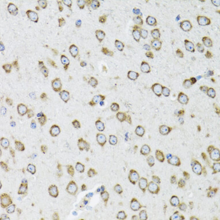 Immunohistochemistry - Anti-OGDH Antibody (A87976) - Antibodies.com