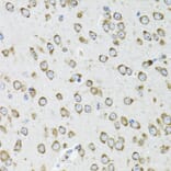 Immunohistochemistry - Anti-OGDH Antibody (A87976) - Antibodies.com