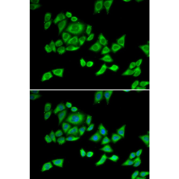 Immunofluorescence - Anti-OGDH Antibody (A87976) - Antibodies.com