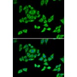 Immunofluorescence - Anti-OGDH Antibody (A87976) - Antibodies.com