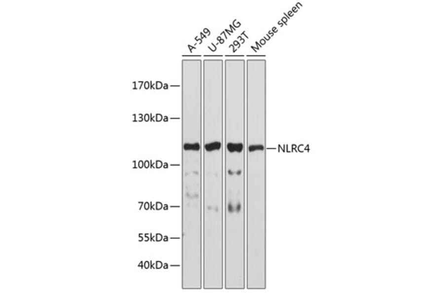 Western Blot - Anti-NLRC4 Antibody (A13117) - Antibodies.com