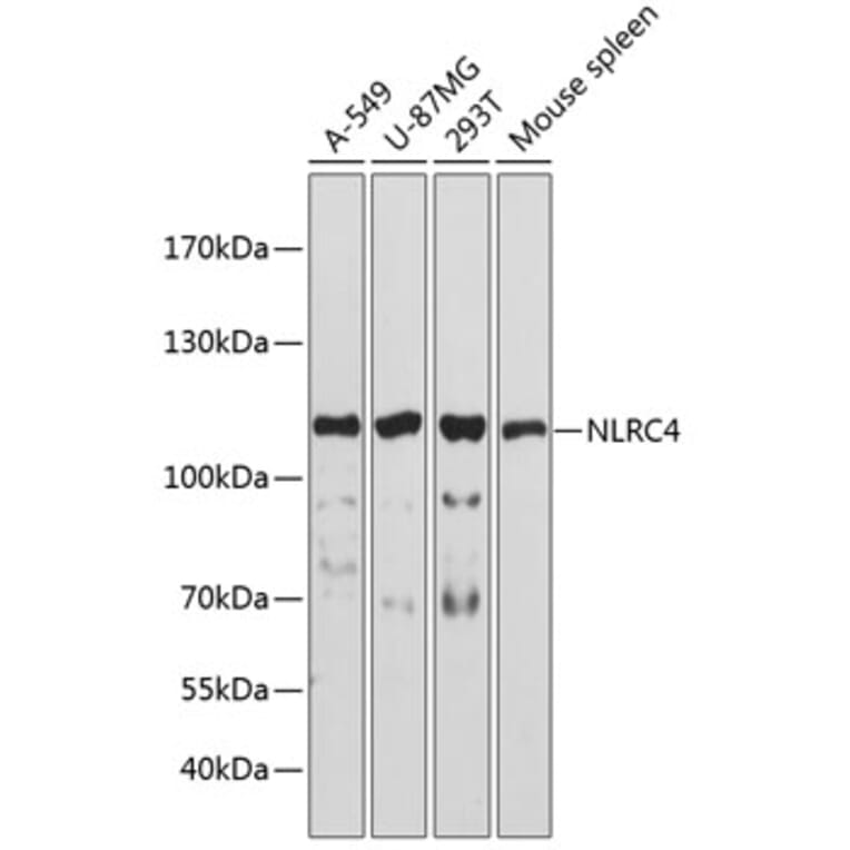 Western Blot - Anti-NLRC4 Antibody (A13117) - Antibodies.com