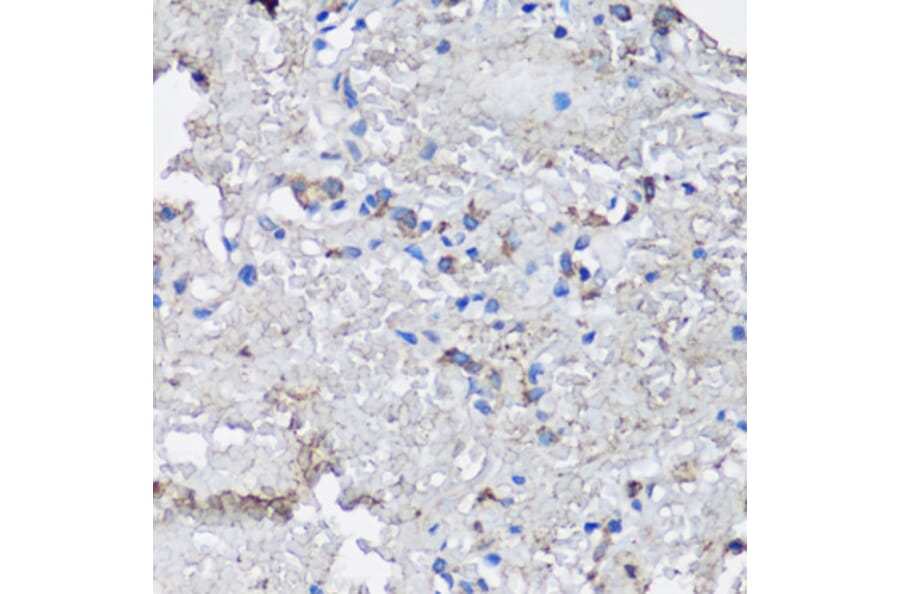 Immunohistochemistry - Anti-NLRC4 Antibody (A13117) - Antibodies.com