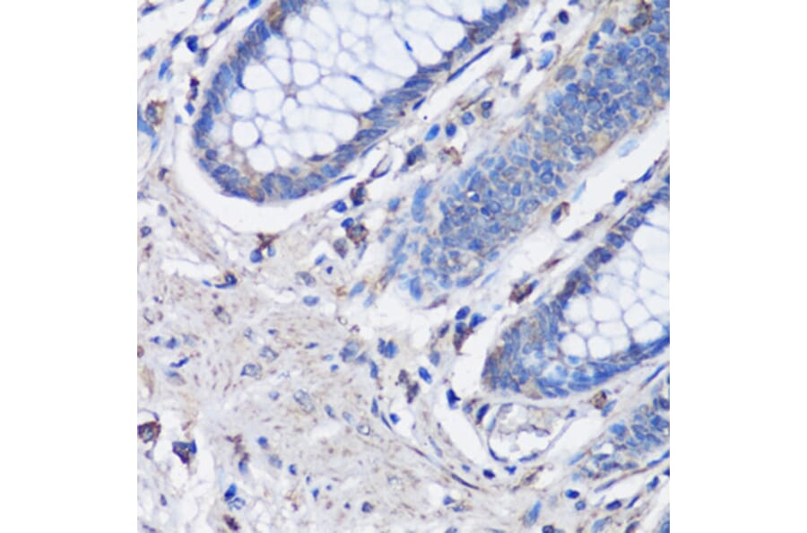 Immunohistochemistry - Anti-NLRC4 Antibody (A13117) - Antibodies.com