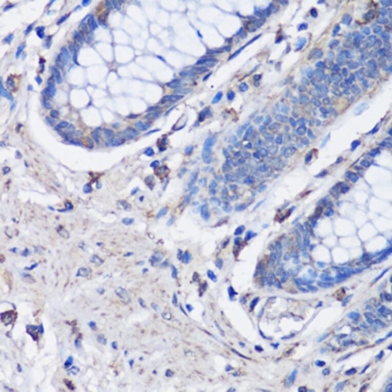 Immunohistochemistry - Anti-NLRC4 Antibody (A13117) - Antibodies.com