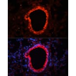 Immunofluorescence - Anti-NLRC4 Antibody (A13117) - Antibodies.com