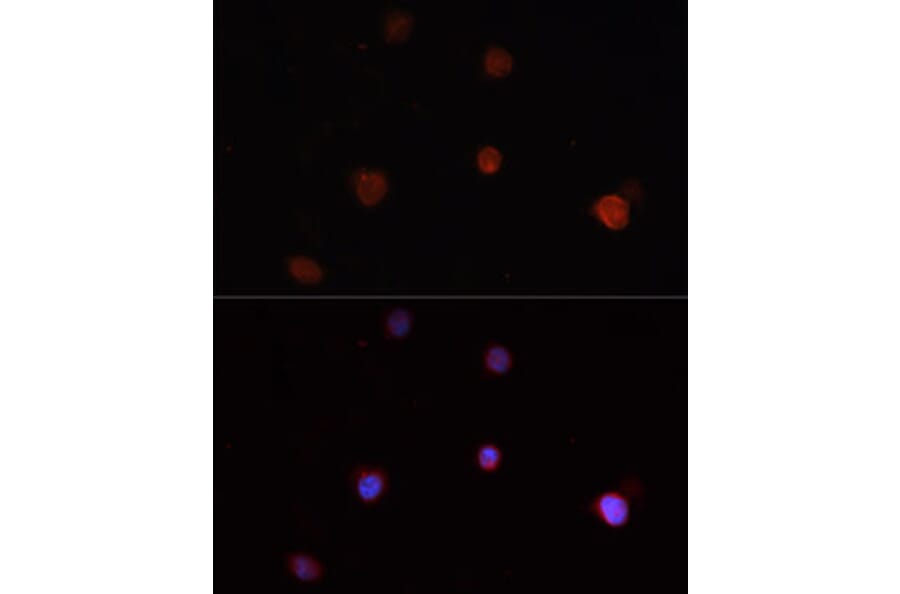 Immunofluorescence - Anti-NLRC4 Antibody (A13117) - Antibodies.com