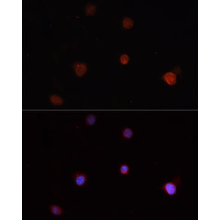 Immunofluorescence - Anti-NLRC4 Antibody (A13117) - Antibodies.com