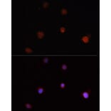 Immunofluorescence - Anti-NLRC4 Antibody (A13117) - Antibodies.com