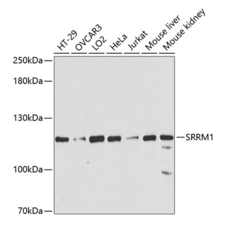 Western Blot - Anti-SRRM1 Antibody (A87978) - Antibodies.com