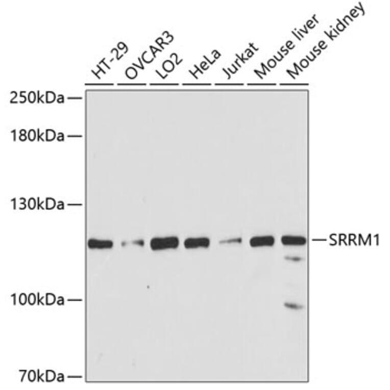Western Blot - Anti-SRRM1 Antibody (A87978) - Antibodies.com