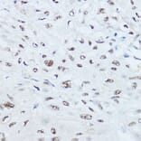 Immunohistochemistry - Anti-SRRM1 Antibody (A87978) - Antibodies.com