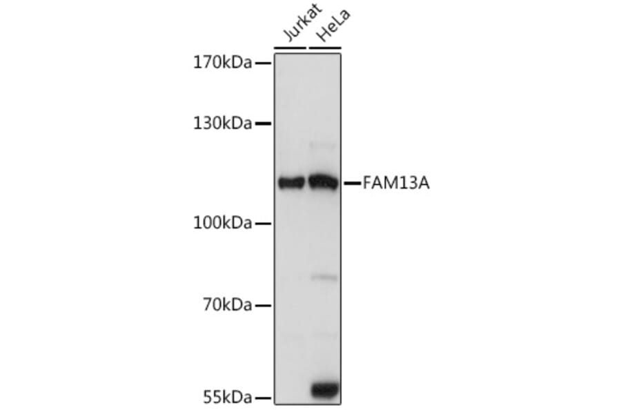 Western Blot - Anti-FAM13A Antibody (A87979) - Antibodies.com