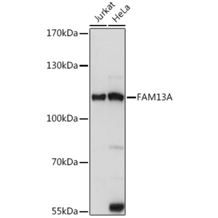 Western Blot - Anti-FAM13A Antibody (A87979) - Antibodies.com