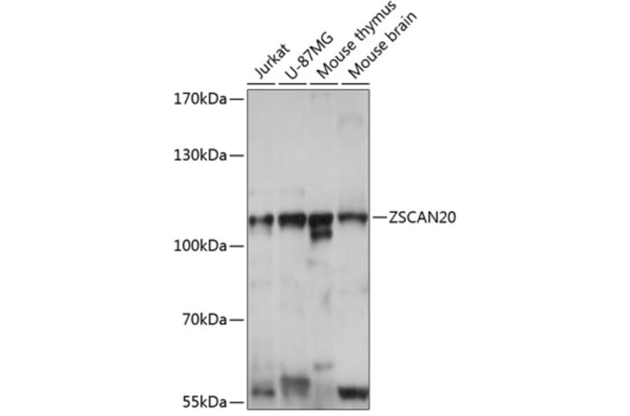 Western Blot - Anti-ZSCAN20 Antibody (A87980) - Antibodies.com