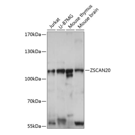 Western Blot - Anti-ZSCAN20 Antibody (A87980) - Antibodies.com