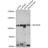 Western Blot - Anti-ZSCAN20 Antibody (A87980) - Antibodies.com