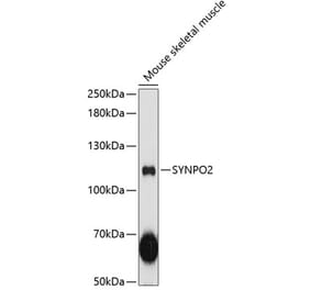 Western Blot - Anti-Synaptopodin 2 Antibody (A87981) - Antibodies.com