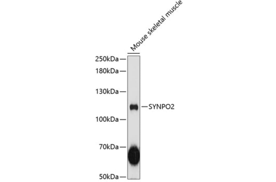 Western Blot - Anti-Synaptopodin 2 Antibody (A87981) - Antibodies.com