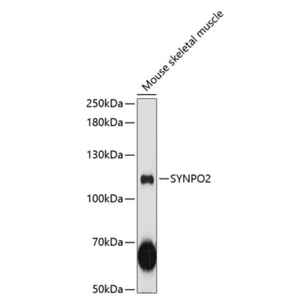 Western Blot - Anti-Synaptopodin 2 Antibody (A87981) - Antibodies.com