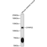 Western Blot - Anti-Synaptopodin 2 Antibody (A87981) - Antibodies.com
