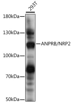 Western blot analysis of extracts of 293T cells, using Anti-NPR2 Antibody (A16061) at 1:1,000 dilution.
Secondary antibody: Goat Anti-Rabbit IgG (H+L) (HRP) (AS014) at 1:10,000 dilution.
Lysates / proteins: 25µg per lane.
Blocking buffer: 3% non-fat dry milk in TBST.
Detection: ECL Basic Kit (RM00020).
Exposure time: 5s.