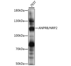 Western Blot - Anti-NPR-B Antibody (A87982) - Antibodies.com