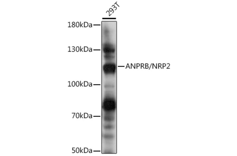 Western Blot - Anti-NPR-B Antibody (A87982) - Antibodies.com