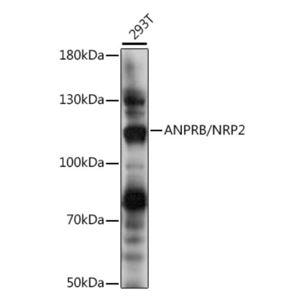 Western Blot - Anti-NPR-B Antibody (A87982) - Antibodies.com