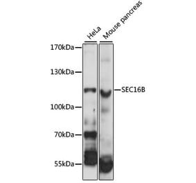 Western Blot - Anti-LZTR2 Antibody (A87984) - Antibodies.com