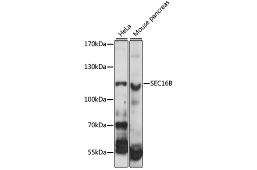 Western Blot - Anti-LZTR2 Antibody (A87984) - Antibodies.com