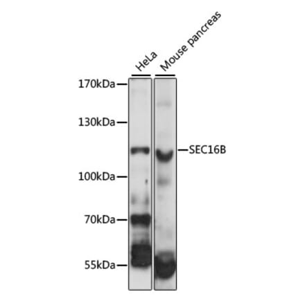 Western Blot - Anti-LZTR2 Antibody (A87984) - Antibodies.com