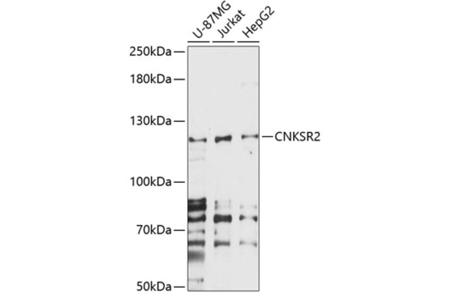 Western Blot - Anti-CNKR2 Antibody (A87985) - Antibodies.com